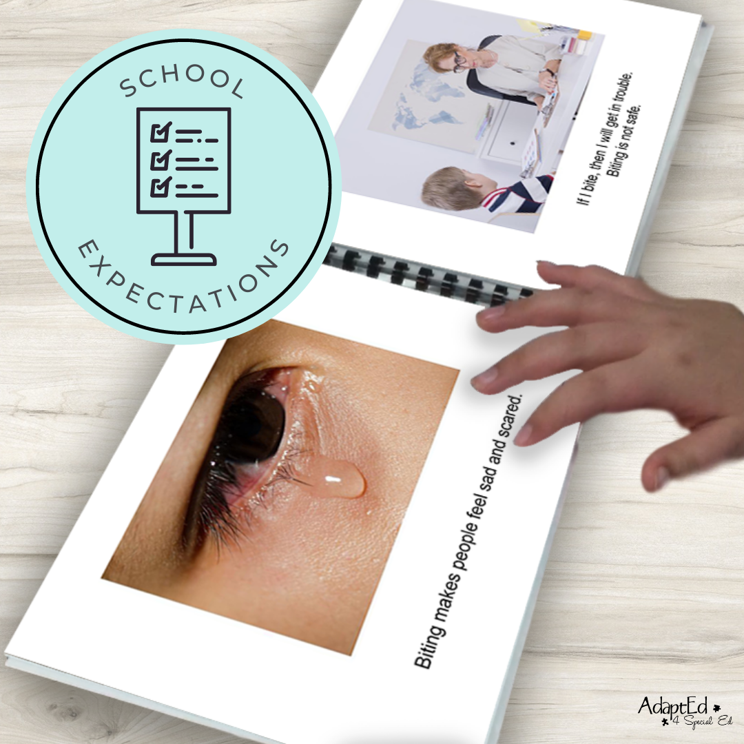 Social Narrative: Biting: Editable (Printable PDF ) Social Skills - AdaptEd4SpecialEd