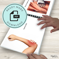 Thumbnail for Social Narrative: Broken Arm: Editable (Printable PDF ) Uncategorized - AdaptEd4SpecialEd