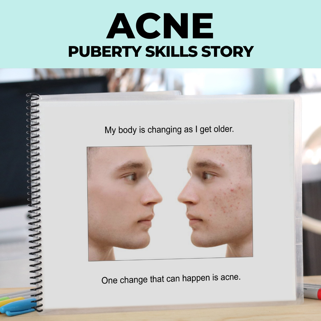 Social Narrative: Acne: Editable (Printable PDF ) Puberty - AdaptEd4SpecialEd
