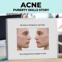 Thumbnail for Social Narrative: Acne: Editable (Printable PDF ) Puberty - AdaptEd4SpecialEd