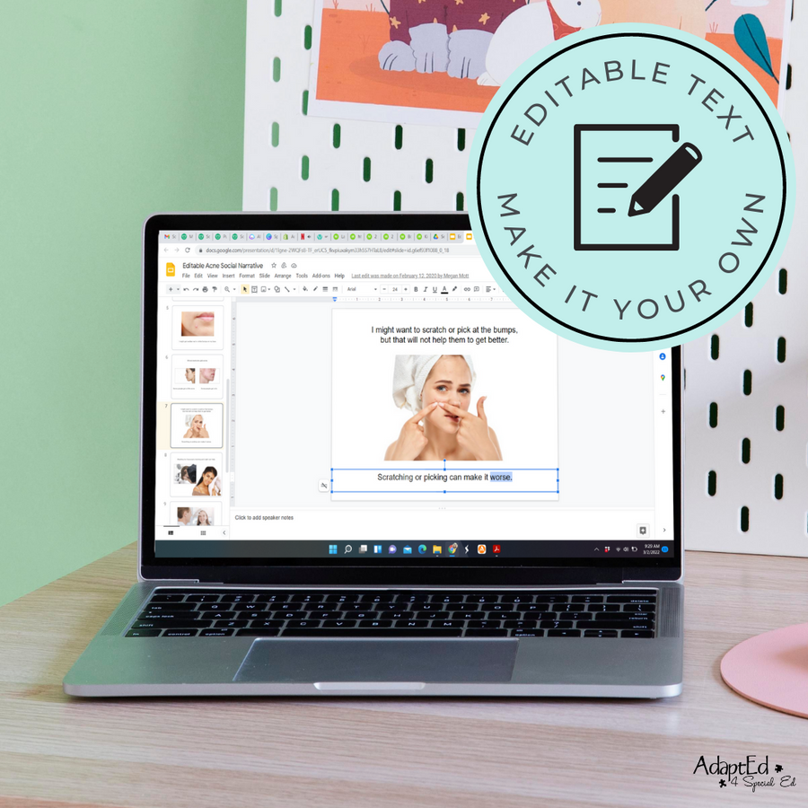 Social Narrative: Acne: Editable (Printable PDF ) Puberty - AdaptEd4SpecialEd
