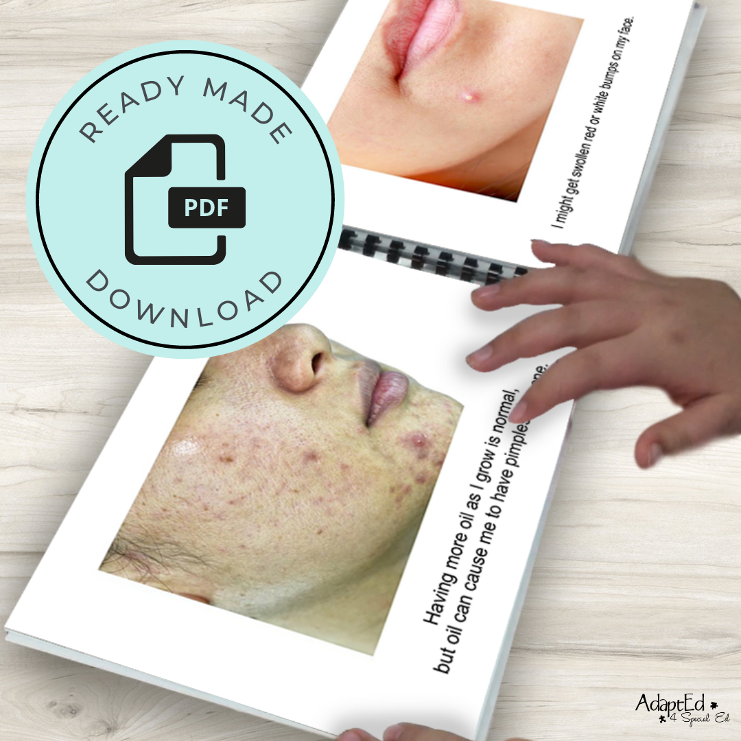 Social Narrative: Acne: Editable (Printable PDF ) Puberty - AdaptEd4SpecialEd